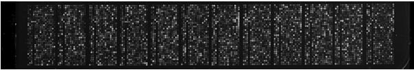 Alterações em transcriptomas durante o desenvolvimento de sementes (estádios embrionários globular, coração e torpedo) nas regiões apical