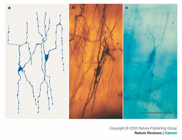 Células Intersticiais de Cajal