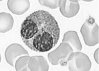 . Eosinopenia: Processos infecciosos Medula óssea Sangue periférico Blastos Promielócitos Mielócitos Metamielócitos Bastões Neutrófilos Basófilos Basofilia: reações inflamatórias cutâneas