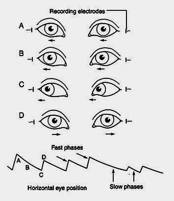 Movimentos de estabilização ocular Movimentos vestíbulo-oculares Reflexos involuntários Nistagmo vestibular Nistagmo são oscilações rítmicas, repetidas e involuntárias de um ou ambos os olhos