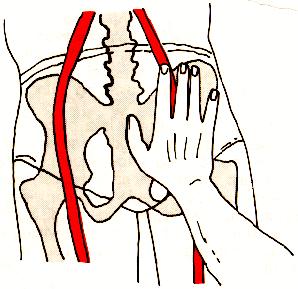 temperatura do corpo, envol-vendo-o com pano embebido por água; Encaminhar para atendimento hospitalar.