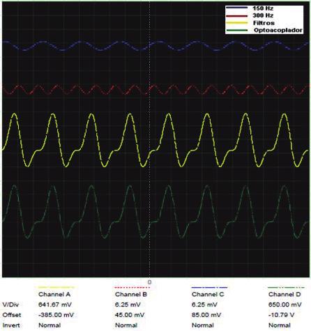 71 Figura 44 - Sinais E, D, Saída ECG e Saída Filtrada do Opto-isolador Fonte: Autoria Própria Em última análise, utilizou-se um arquivo que contém o resultado de um eletrocardiograma (PHYSIONET,