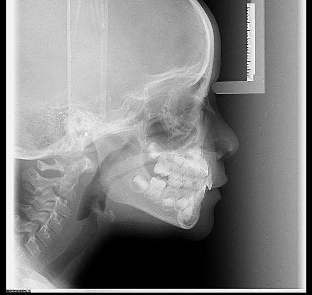 C)Lateral Esquerdo D) oclusal superior E) Oclusal inferior.