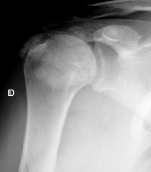 RADIOLOGIA Exames radiográficos Deve ser o primeiro exame nas