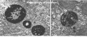 Lisossomos - Presentes em células eucariontes de