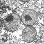 Peroxissomos - Presentes nas células eucariontes (fungos, vegetais e maioria dos animais) - Estruturas