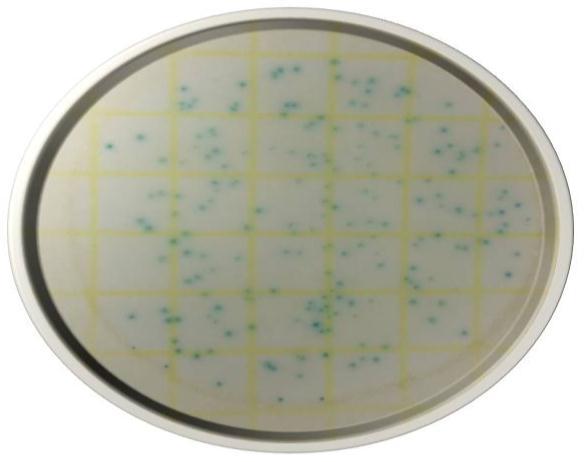 66 Figura 5 - Determinação da população de bactérias ácido láticas - BAL Figura 4 - Determinação da população de leveduras - LEV 3.2.