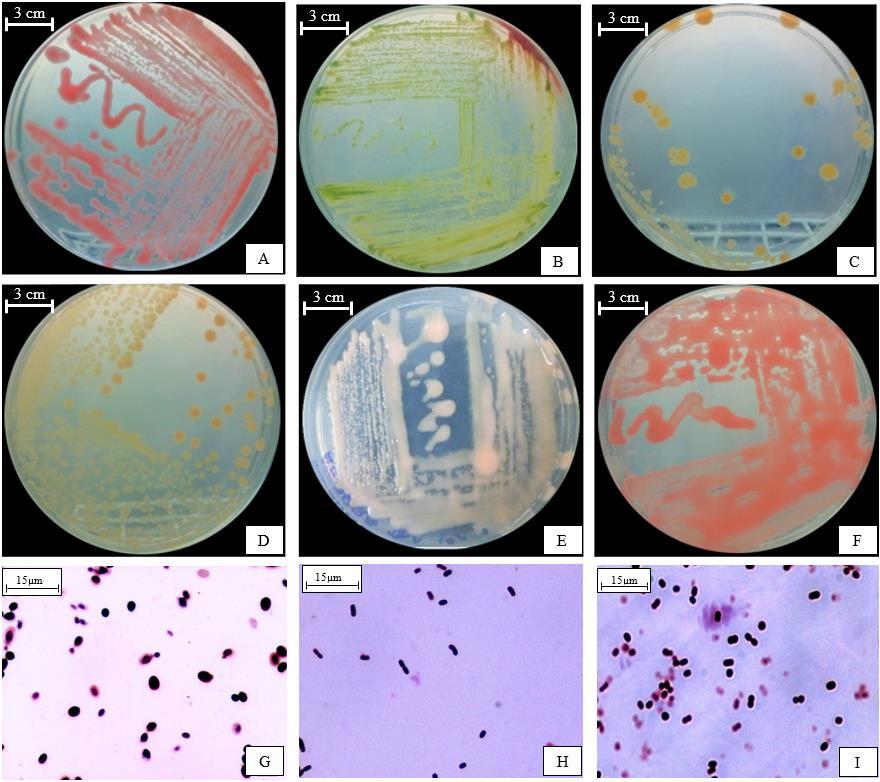 As amostras de IControle apresentaram um padrão na coloração de microrganismos (clara), sendo que em maiores diluições houve a ausência de microrganismos ou o aparecimento em quantidades inferiores