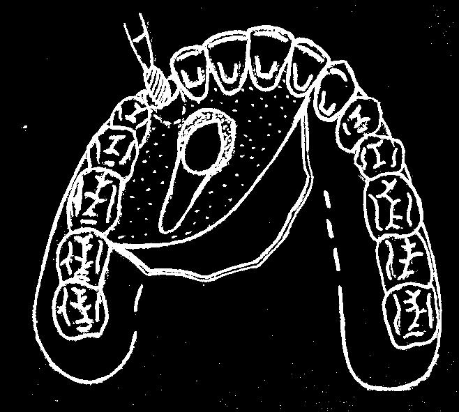 Schatz et Joho, 1993; Tsukiboshi, 2002; Bauss et al, 2008).