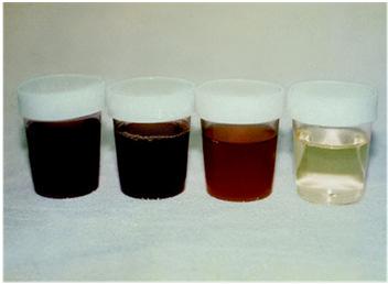 Densidade ph Aumento: Glicosúria, secreção de HAD, hepatopatia, vômitos, diarreia, ICC, febre, desidratação.