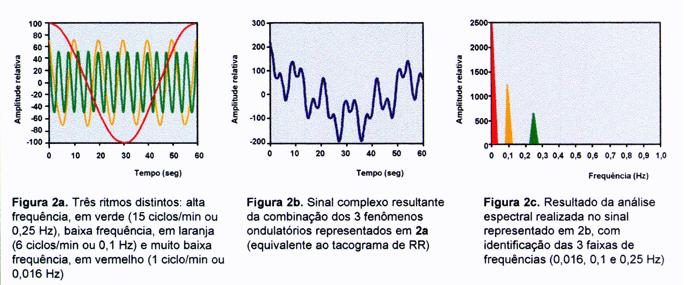 26 Figura 5 Análise Hipotética do Domínio da Frequência (Fonte: www.cardios.