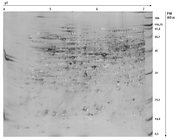 61 Figura 17 Separação das proteínas do caule de Eucalyptus grandis com cinco meses por eletroforese bidimensional.