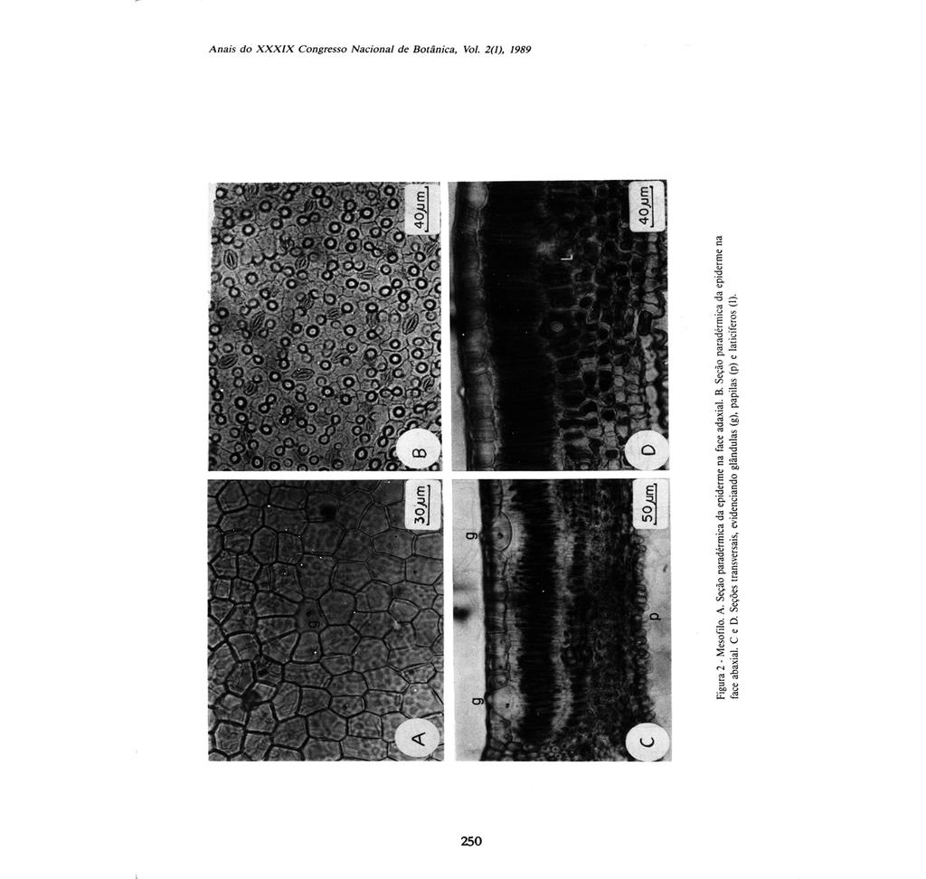 "'., o '1 I g.",!!l'ri ai 'r' - Figura 2 - Mesofilo. A. Seção paradérmica da epiderme na face adaxial. B. Seção paradérmica da epiderme na face abaxial.