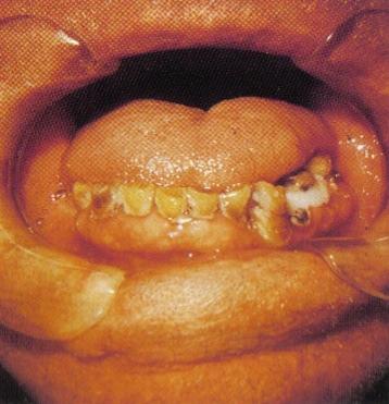 cirurgia oral.