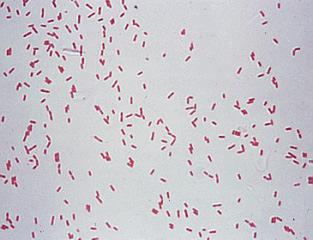 Pseudomonas aeruginosa Bastonetes Gram