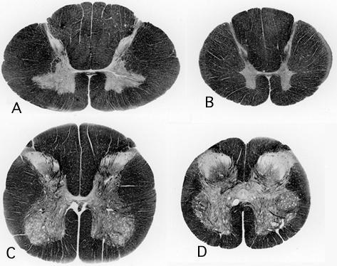 SEGMENTAÇÃO MEDULAR cervical torácica lombar