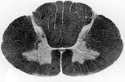 SULCOS LONGITUDINAIS Fissura mediana anterior Sulco mediano posterior Sulco intermédio posterior (apenas na medula cervical) Sulco lateral anterior Sulco lateral posterior (raízes ventrais e dorsais)