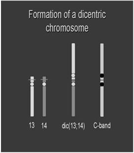 REARRANJOS NÃO-BALANCEADOS: quando há material cromossômico adicional ou