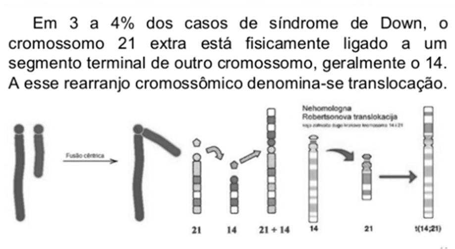 A síndrome de Down pode ser causada tanto por alteração numérica como por alterações estruturais Translocação - 4% - 21q - cromossomo do grupo D ou G (acrocêntricos) Ex.