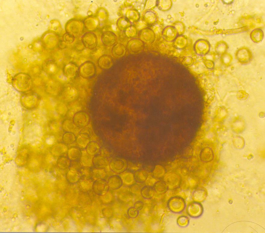 Cleistotécio Reprodução Sexuada: Estruturas reprodutivas Ascocarpos