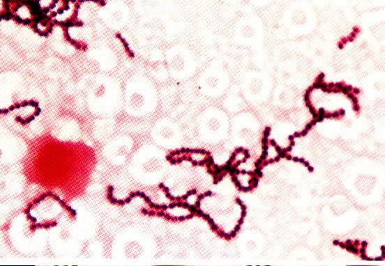 Microscopia e Métodos de Coloração Bacteriana 14