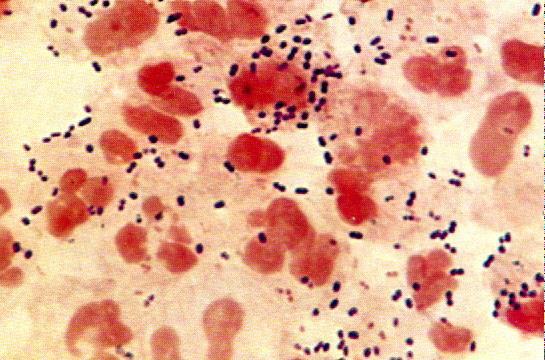 Microscopia e Métodos de Coloração Bacteriana 15