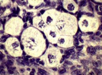 Multinucleate follicles in Nelore (A) and Aberdeen Angus (B) heifer.