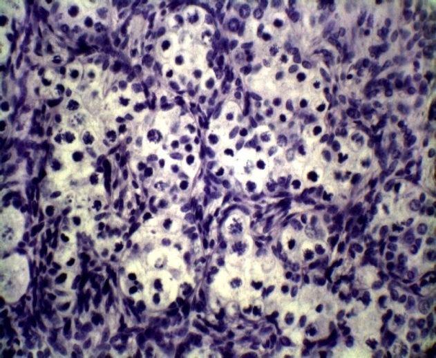 Presumptive nucleus of oocytes (Nu) enclosed within a follicle-like cell with a single