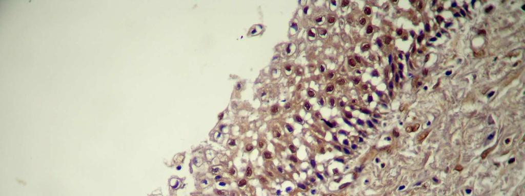 Figura 13 Expressão imuno-histoquímica de