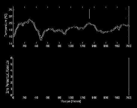 de ruído branco de média zero e desvio padrão σ = 0.25. A Figura 5.