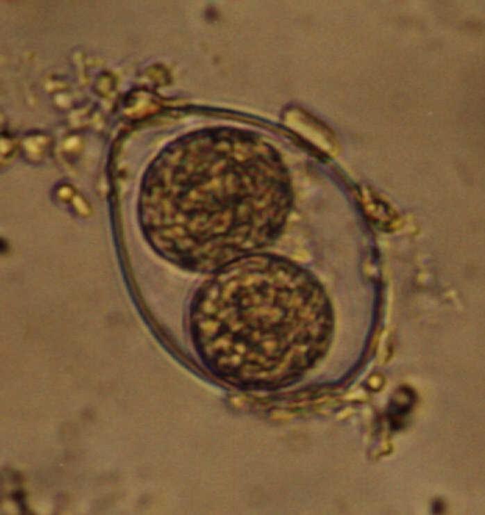 Isosporose/Isosporíase Ø Agente etiológico: ü Isospora belli (Woodcook, 1915) Ø Taxonomia: ü