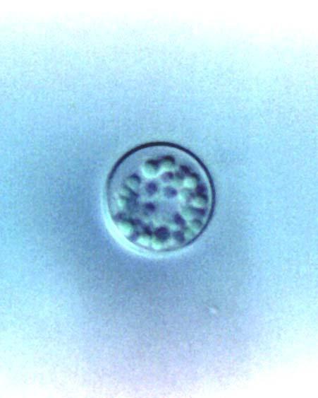 Ciclosporose/Ciclosporíase Ø Agente etiológico: Cyclospora cayetanensis (Ashford, 1979) Ø Taxonomia: ü