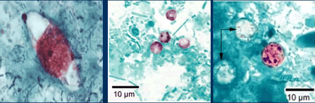 Coccídios intestinais I.