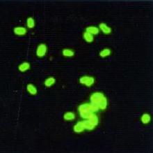 Microscopia eletrônica ü