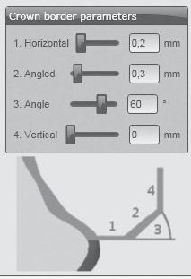 APLICAÇÃO Parâmetros das bordas no software CAD de Ceramill Mind Para Ceramill Zolid FX se deve prestar atenção para que as espessuras das bordas sejam suficientes. Valores recomendados são: _ 1.