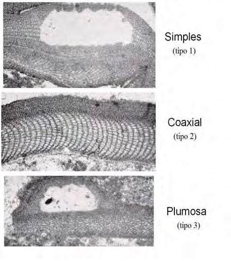 Figura Ap. 32 Tipos de hipotalo presentes nas coralináceas. Fonte: Johnson (19