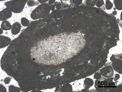 Oncóide superficial, pois o diâmetro do núcleo (no caso, a alga vermelha) é menor que o córtex.