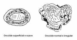 Sua morfologia é altamente dependente da forma do núcleo, tendo maior ou menor importância na construção de um oncóide dependendo se o diâmetro é menor ou maior que a espessura total das laminações