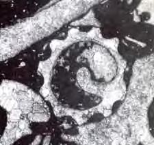 - Morfologia: a concha dos gastrópodes é composta por uma só valva, não septada, em forma de cone, que pode ou não apresentar um enrolamento.