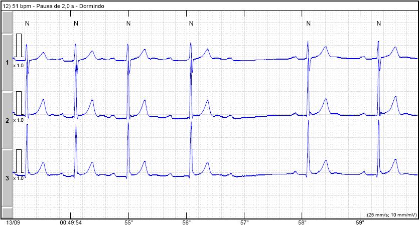 Homem jovem com atividade física regular sem cardiopatia