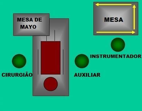 O posicionamento da mesa de instrumental também sofre diversas variações, as quais dependem da preferência do cirurgião.