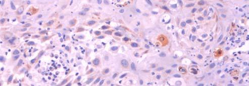 imuno-marcação da proteína c-cas-3 (setas)