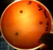 Figura 2 - Halos de inibição formados pela atividade antimicrobiana do óleo puro sobre o Streptococcus sp.