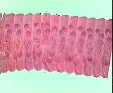 LAM Nº 51 Hymenolepis nana (proglote madura) Coloração: Carmin Material de preparação: Fezes