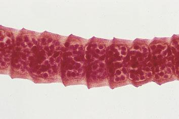 LAM Nº 52 Hymenolepis nana (proglote gravídica) Coloração: Carmin Material de preparação: Fezes