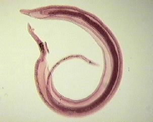 LAM Nº 40 Shistosoma mansoni (vermes adultos macho e fêmea) Coloração: Carmin Material de preparação: sangue Características: ambos os sexos