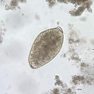Fasciola hepatica (ovo) Características: Forma oval,