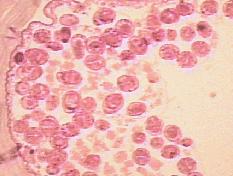 LAM Nº 49 Echinococcus granulosus (areia hidática)
