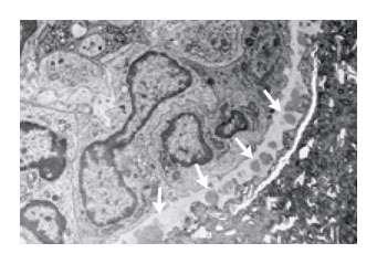 Microscopia eletrônica.