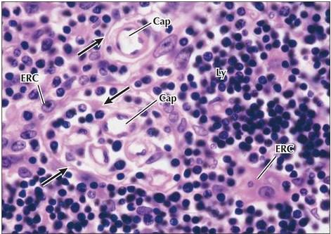 Timo ERC: Célula reticuloepitelial Barreira hematotímica: Lâmina basal das ERC se funde com a lâmina basal do endotélio capilar.